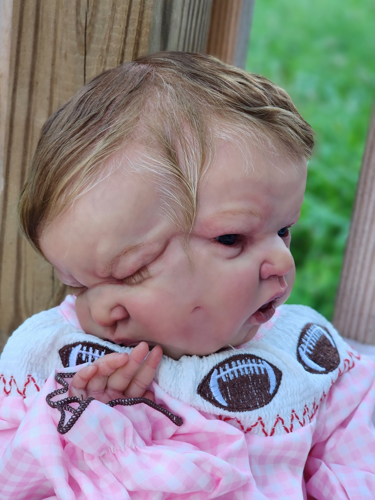 Authentic Conjoined Twins Made From “Gianna&Giulia” Kit Sold Out Limited Edition